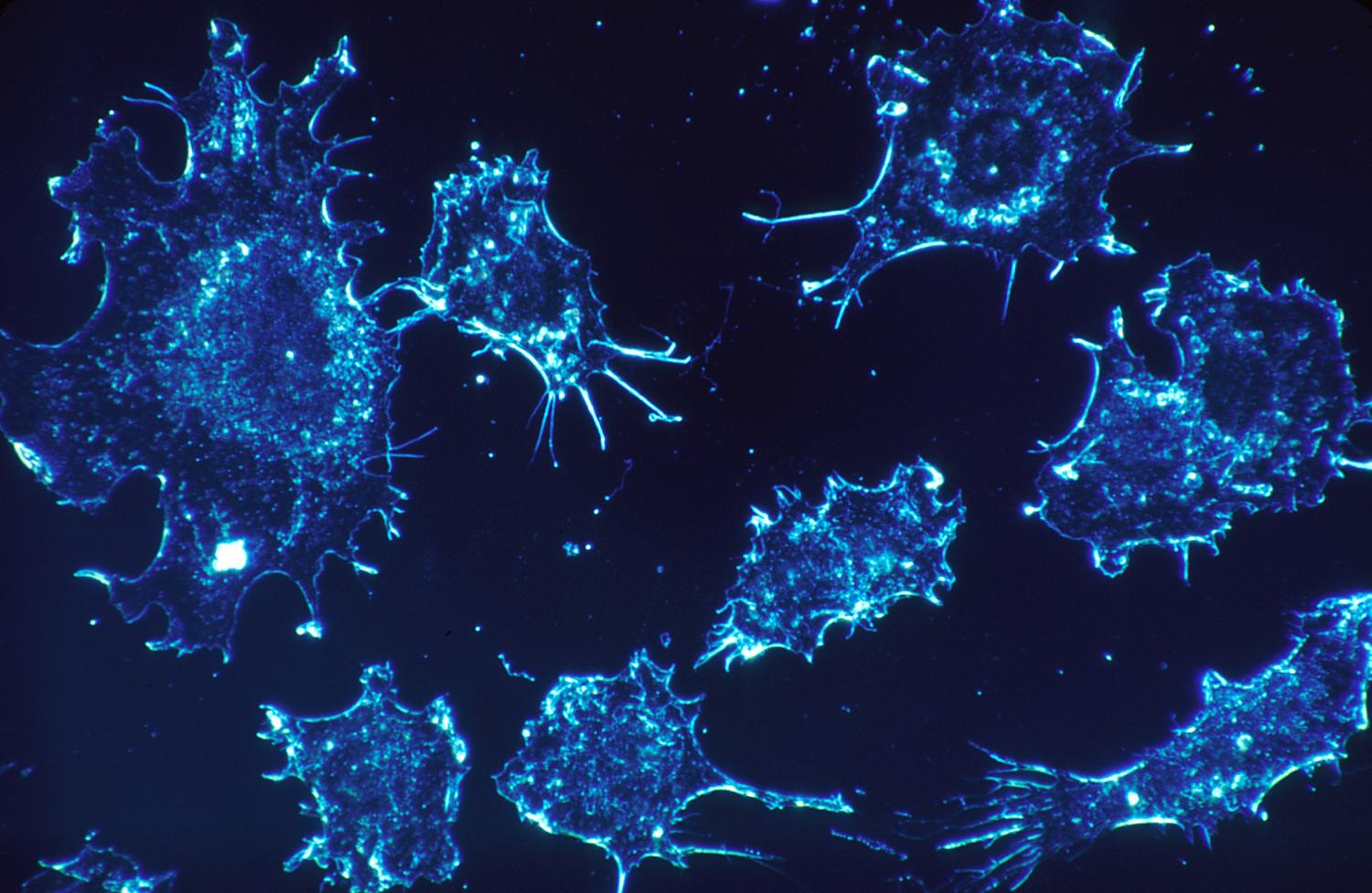 Researchers develop treatment that turns tumors into cancer vaccine factories