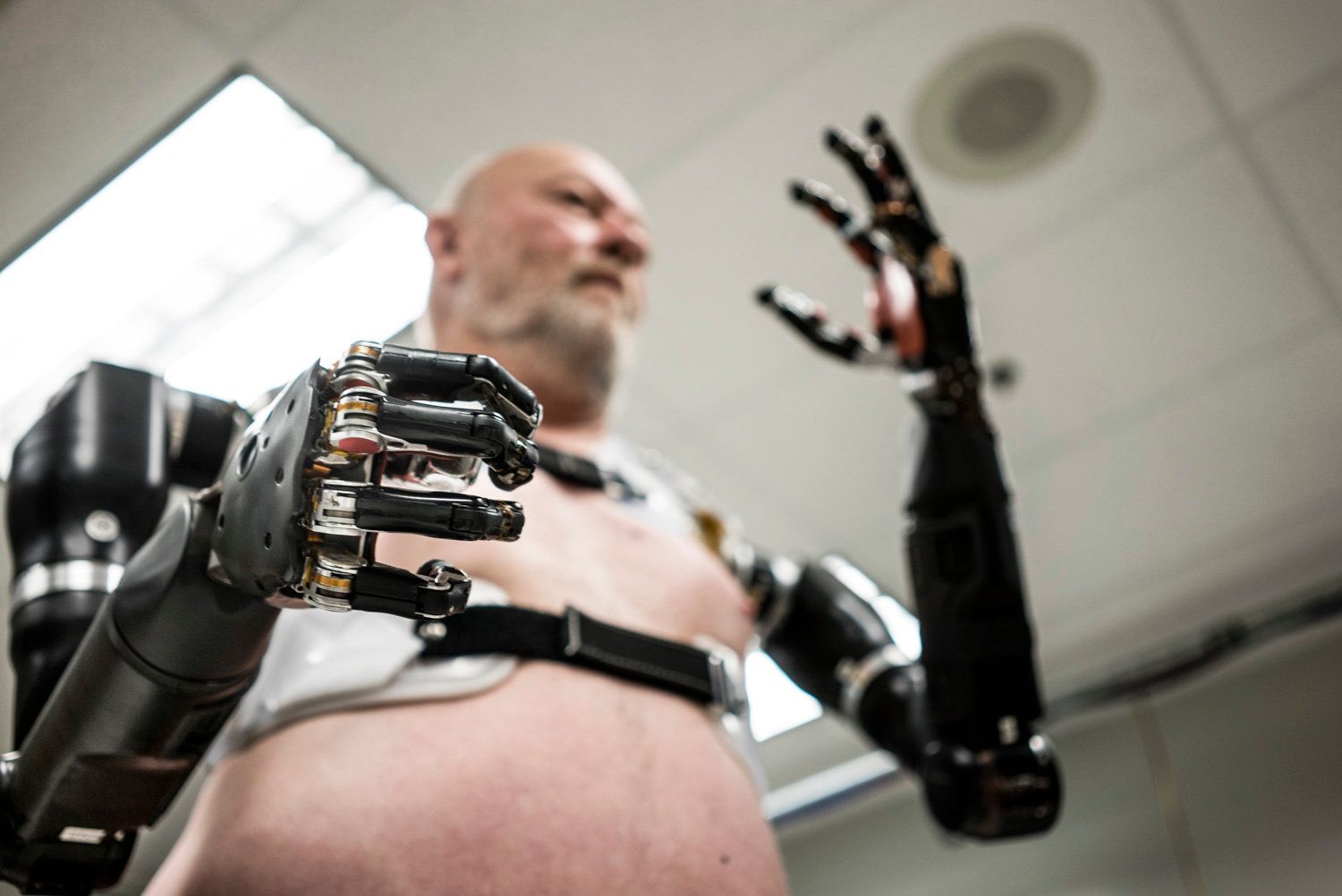 Mind Controlled Prosthetics