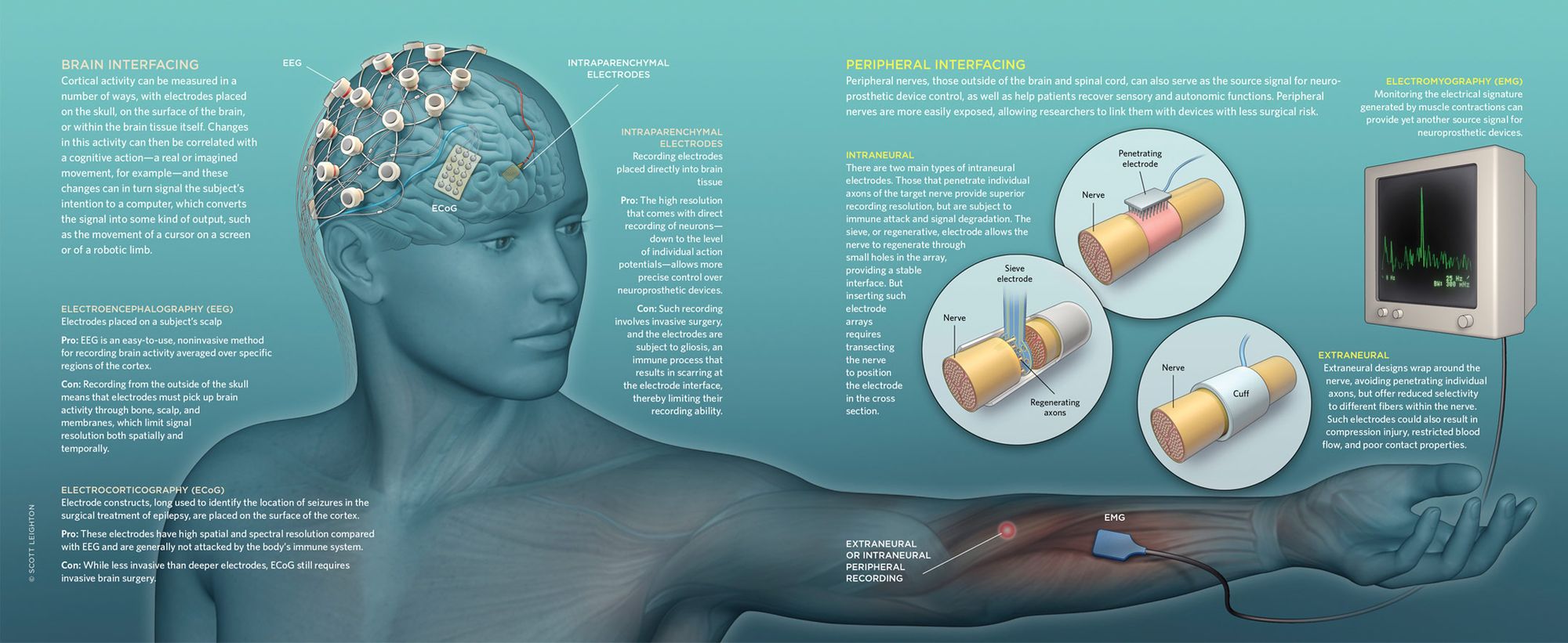 Neuroprosthetics - Intelligent Spinal Interface